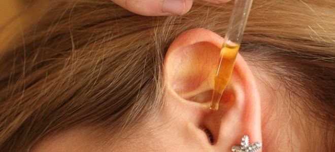 Гнойный отит – симптомы и лечение у взрослых