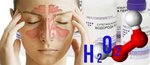 Перекись водорода при гайморите: лечение, отзывы