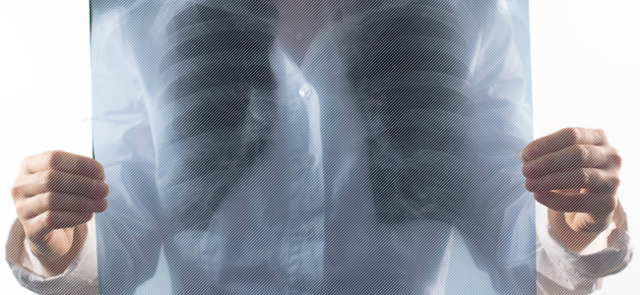 Как передаётся туберкулёз закрытой формы