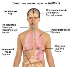 Свиной грипп — симптомы a h1n1 у человека