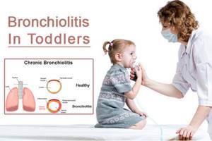 Бронхиолит: что это такое, симптомы у детей и взрослых в острой инфекционной форме, клинические рекомендации по лечению, хроническое течение, народные средства