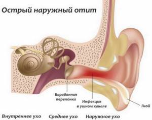 Можно ли перекисью водорода чистить уши самостоятельно в домашних условиях