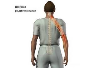 Боль в грудной клетке справа при вдохе и движении