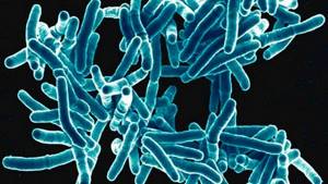 Как можно заразиться туберкулезом, пути и способы заражения