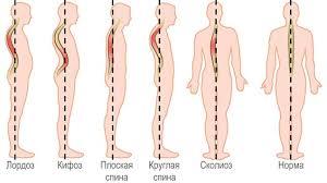 Жжение в грудной клетке: у мужчин, женщин, справа, слева, посередине, причины