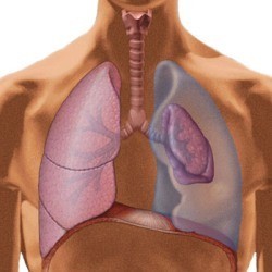 Подкожная эмфизема грудной клетки: причины, лечение и возможные осложнения