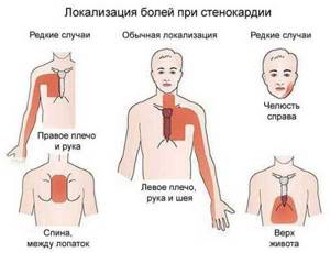 Боль в грудине справа: причины у женщин, мужчин