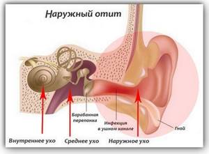 Болит горло и ухо: с одной стороны, справа, слева