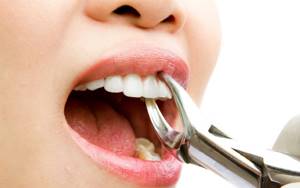 Ротокан: инструкция по применению для полоскания зубов, при флюсе и зубной боли