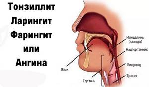 Леденцы от боли в горле: недорогие, но эффективные, с анестетиком, для детей и взрослых