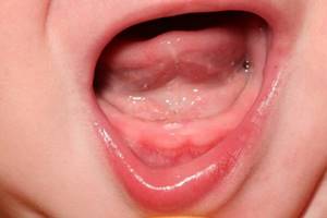 Температура 39 у ребенка: что делать, почему бывает без признаков простуды, нужно ли сбивать, как быть, если лихорадка держится третий день, реакция на зубы