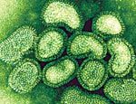 Почему люди умирают от свиного гриппа a (h1n1)