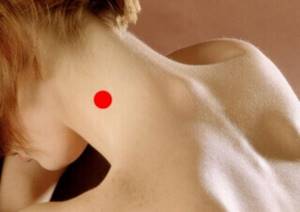 Увеличение лимфоузлов на шее: причины, с одной стороны, справа, слева, задние