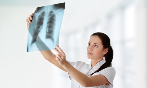 Инфильтративный туберкулез легких – симптомы и лечение