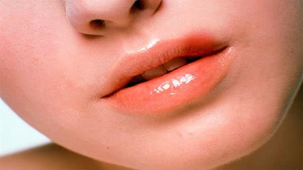 Простуда (герпес) на губах – лечение в домашних условиях