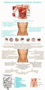 Опоясывающая боль в области грудной клетки и спины