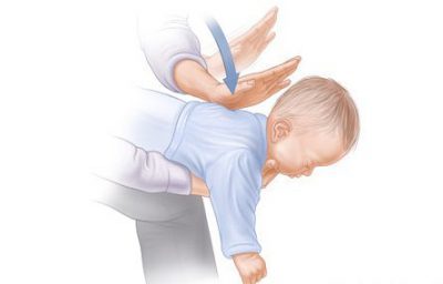 Сухой кашель у ребенка: причины сильных и частых приступов, если непрекращающиеся, доходящие до рвоты, как облегчить, у грудничка, если затяжной и не проходит