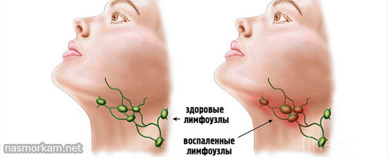 Болит горло и ухо: с одной стороны, справа, слева