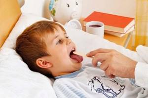 ОРВИ (острая респираторная вирусная инфекция) у детей симптомы и лечение